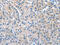 Choriogonadotropin subunit beta antibody, CSB-PA990883, Cusabio, Immunohistochemistry paraffin image 