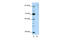 GLIS Family Zinc Finger 3 antibody, ARP39924_T100, Aviva Systems Biology, Western Blot image 