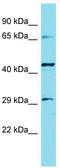 Kelch Like Family Member 30 antibody, TA337395, Origene, Western Blot image 