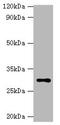 Hydroxysteroid 11-Beta Dehydrogenase 1 antibody, A56290-100, Epigentek, Western Blot image 