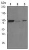 DNA Methyltransferase 3 Beta antibody, ab79822, Abcam, Western Blot image 