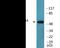 Checkpoint Kinase 1 antibody, EKC2236, Boster Biological Technology, Western Blot image 