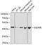 Gasdermin B antibody, GTX66495, GeneTex, Western Blot image 