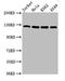 DNA Polymerase Delta 1, Catalytic Subunit antibody, CSB-PA018303LA01HU, Cusabio, Western Blot image 