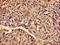 Ataxin 3 antibody, LS-C369297, Lifespan Biosciences, Immunohistochemistry paraffin image 