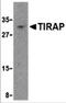 TIR Domain Containing Adaptor Protein antibody, 3155, ProSci, Western Blot image 