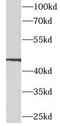 Calcitonin Receptor Like Receptor antibody, FNab09879, FineTest, Western Blot image 