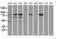 Catenin Beta 1 antibody, GTX84650, GeneTex, Western Blot image 
