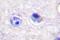 Acetyl-CoA Carboxylase Alpha antibody, LS-C192173, Lifespan Biosciences, Immunohistochemistry paraffin image 