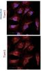 T Cell Lymphoma Invasion And Metastasis 1 antibody, NBP2-75096, Novus Biologicals, Immunocytochemistry image 