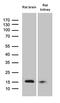 Fragile Histidine Triad Diadenosine Triphosphatase antibody, M01200-2, Boster Biological Technology, Western Blot image 