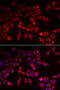 Glycogen Phosphorylase L antibody, 22-426, ProSci, Immunofluorescence image 