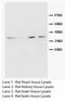 Aquaporin 4 antibody, LS-C172004, Lifespan Biosciences, Western Blot image 