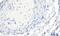 Actin Alpha 2, Smooth Muscle antibody, PA5-18292, Invitrogen Antibodies, Immunohistochemistry paraffin image 