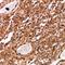 Megakaryocyte-Associated Tyrosine Kinase antibody, LS-C667892, Lifespan Biosciences, Immunohistochemistry paraffin image 
