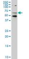 Nuclear Receptor Subfamily 1 Group D Member 1 antibody, H00009572-M05, Novus Biologicals, Western Blot image 