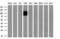 Neurotrophic Receptor Tyrosine Kinase 3 antibody, GTX83978, GeneTex, Western Blot image 