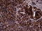 IQ Motif Containing GTPase Activating Protein 1 antibody, LS-C792264, Lifespan Biosciences, Immunohistochemistry paraffin image 