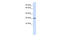 Vesicle Transport Through Interaction With T-SNAREs 1A antibody, 26-701, ProSci, Western Blot image 