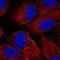 Versican antibody, NBP1-85432, Novus Biologicals, Immunocytochemistry image 