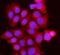 Branched Chain Keto Acid Dehydrogenase Kinase antibody, A07798-2, Boster Biological Technology, Immunofluorescence image 