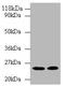 3-Hydroxy-3-Methylglutaryl-CoA Reductase antibody, LS-C285529, Lifespan Biosciences, Western Blot image 