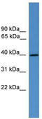 Arginine Vasopressin Receptor 2 antibody, TA342645, Origene, Western Blot image 