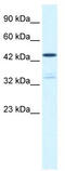 Potassium Voltage-Gated Channel Subfamily A Regulatory Beta Subunit 3 antibody, TA338542, Origene, Western Blot image 