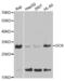Deoxycytidine Kinase antibody, abx001486, Abbexa, Western Blot image 