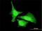 Mitogen-Activated Protein Kinase Kinase Kinase 20 antibody, H00051776-M05, Novus Biologicals, Immunofluorescence image 