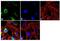 TIMP Metallopeptidase Inhibitor 1 antibody, MA5-13688, Invitrogen Antibodies, Immunofluorescence image 