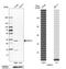 Heme Oxygenase 1 antibody, HPA000635, Atlas Antibodies, Western Blot image 