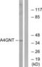 Alpha-1,4-N-Acetylglucosaminyltransferase antibody, LS-C119714, Lifespan Biosciences, Western Blot image 