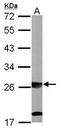 SBDS Ribosome Maturation Factor antibody, GTX109168, GeneTex, Western Blot image 