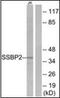 Single Stranded DNA Binding Protein 2 antibody, orb94869, Biorbyt, Western Blot image 