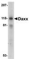 Death Domain Associated Protein antibody, NBP1-77011, Novus Biologicals, Western Blot image 