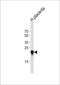 Chorionic Somatomammotropin Hormone Like 1 antibody, LS-C167087, Lifespan Biosciences, Western Blot image 