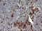 Matrix Metallopeptidase 13 antibody, LS-C338160, Lifespan Biosciences, Immunohistochemistry frozen image 