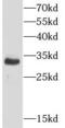 NPHS2 Stomatin Family Member, Podocin antibody, FNab05819, FineTest, Western Blot image 