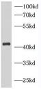 NPHS2 Stomatin Family Member, Podocin antibody, FNab05819, FineTest, Western Blot image 