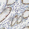 Tau Tubulin Kinase 2 antibody, A7609, ABclonal Technology, Immunohistochemistry paraffin image 