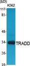 TNFRSF1A Associated Via Death Domain antibody, A02785-1, Boster Biological Technology, Western Blot image 