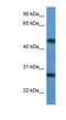 TM2 Domain Containing 2 antibody, NBP1-79845, Novus Biologicals, Western Blot image 