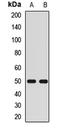 Potassium Voltage-Gated Channel Subfamily J Member 4 antibody, LS-C667873, Lifespan Biosciences, Western Blot image 