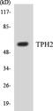 Tryptophan Hydroxylase 2 antibody, EKC1573, Boster Biological Technology, Western Blot image 