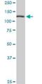 Tubulin Folding Cofactor D antibody, H00006904-B01P, Novus Biologicals, Western Blot image 