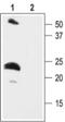 Potassium Voltage-Gated Channel Subfamily E Regulatory Subunit 2 antibody, PA5-77607, Invitrogen Antibodies, Western Blot image 