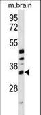 Methyltransferase Like 6 antibody, LS-C158135, Lifespan Biosciences, Western Blot image 