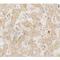 C-C Motif Chemokine Receptor 7 antibody, LS-C201180, Lifespan Biosciences, Immunohistochemistry frozen image 