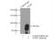 Transglutaminase 1 antibody, 12912-3-AP, Proteintech Group, Immunoprecipitation image 